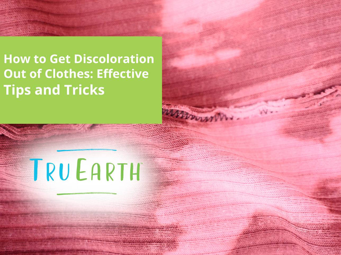 How to Get Discoloration Out of Clothes: Effective Tips and Tricks
